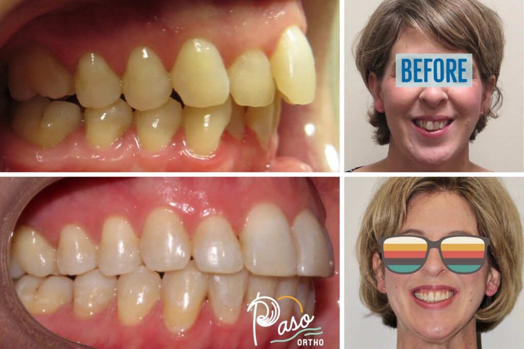 orthodontist atascadero ca