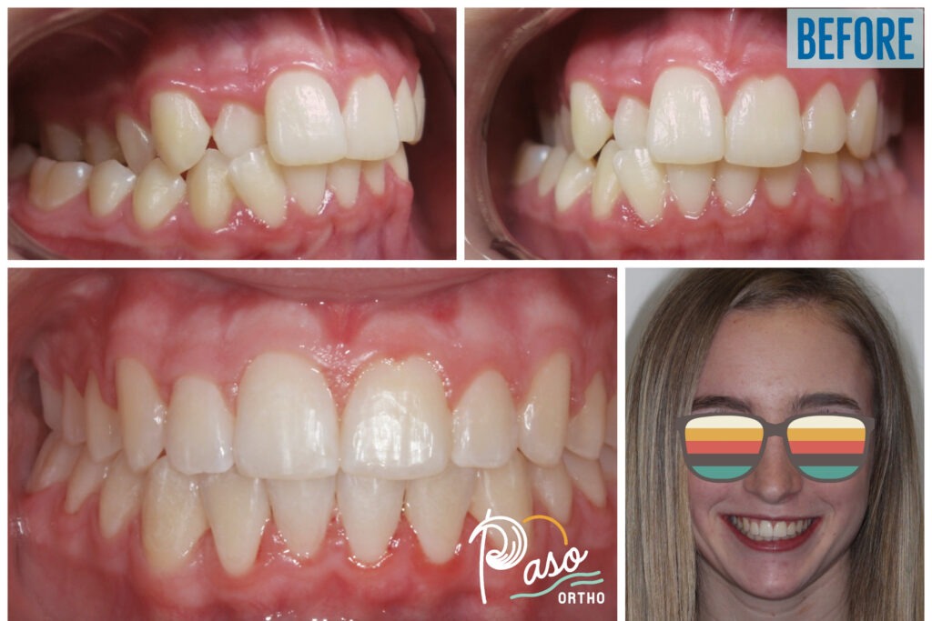 orthodontist atascadero ca