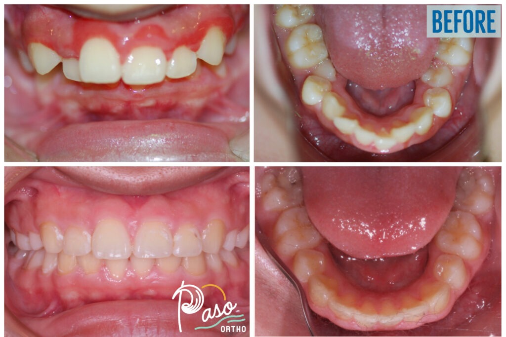 orthodontist atascadero ca