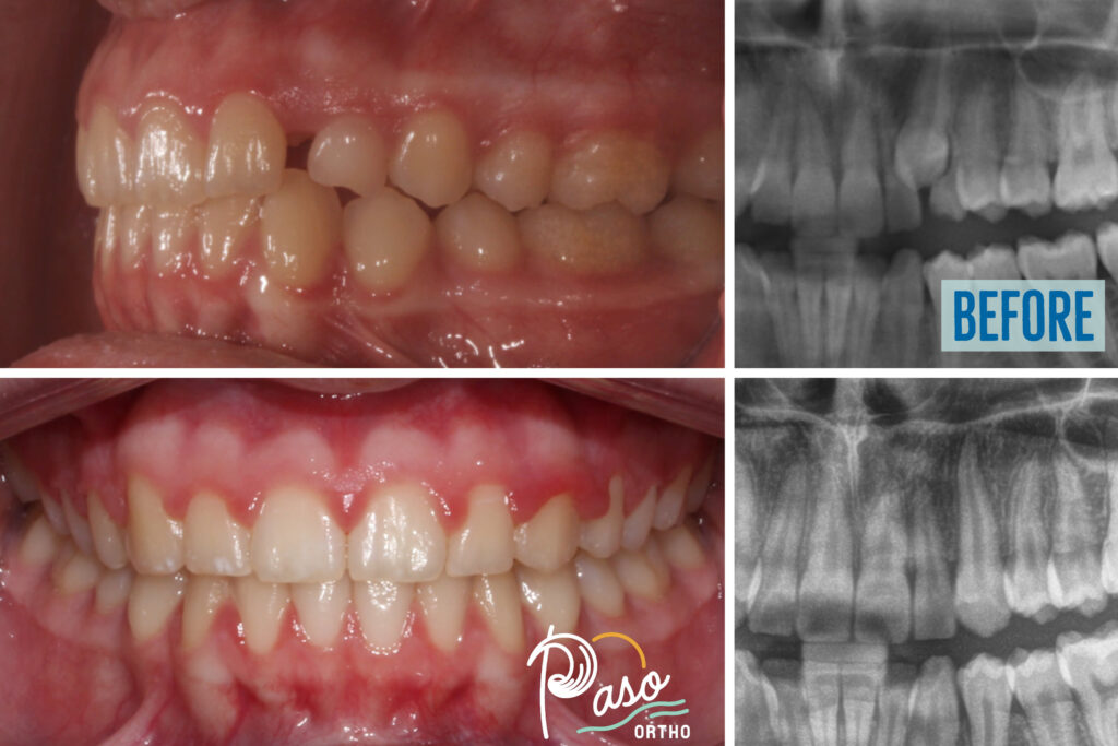 orthodontist atascadero ca