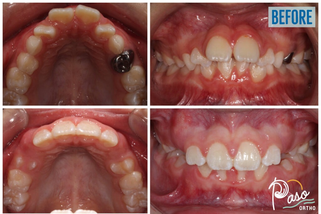 orthodontist atascadero ca