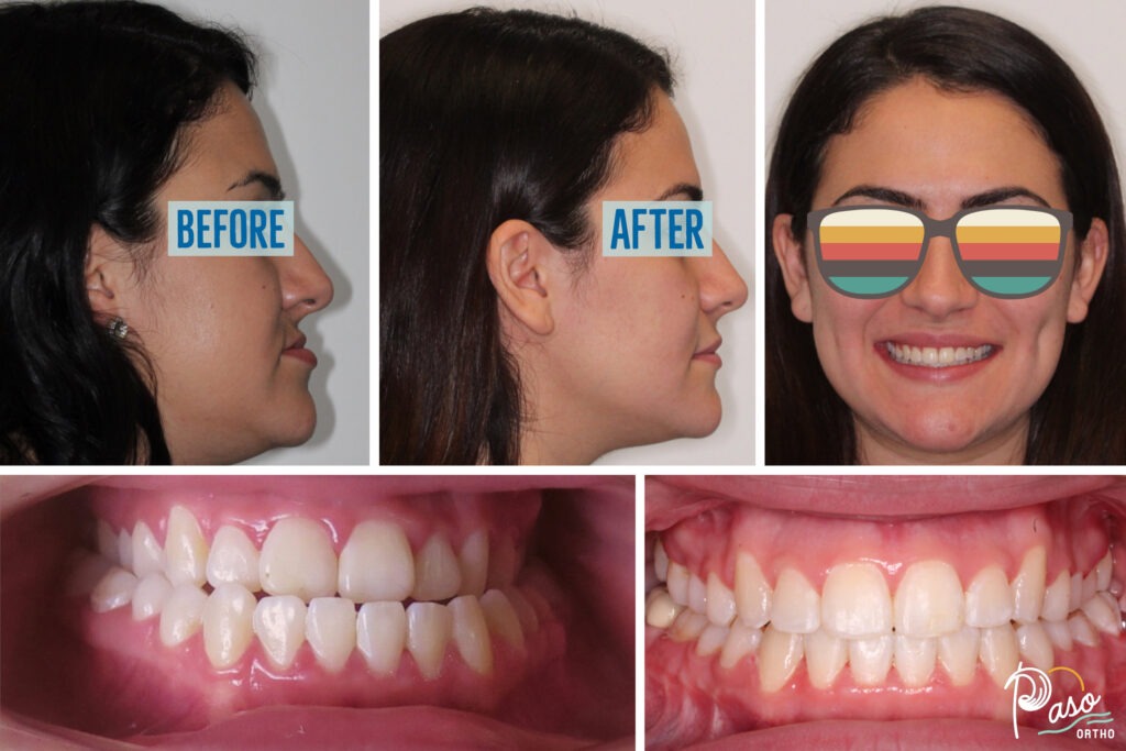 orthodontist atascadero ca