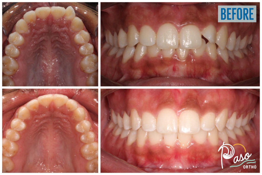orthodontist atascadero ca