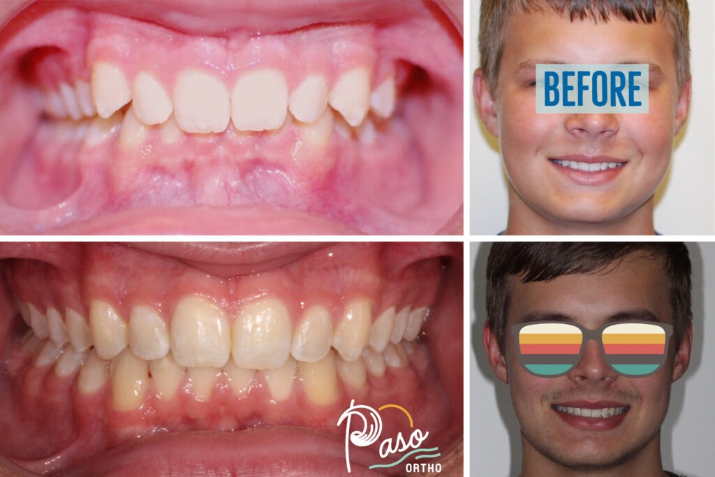 orthodontist atascadero