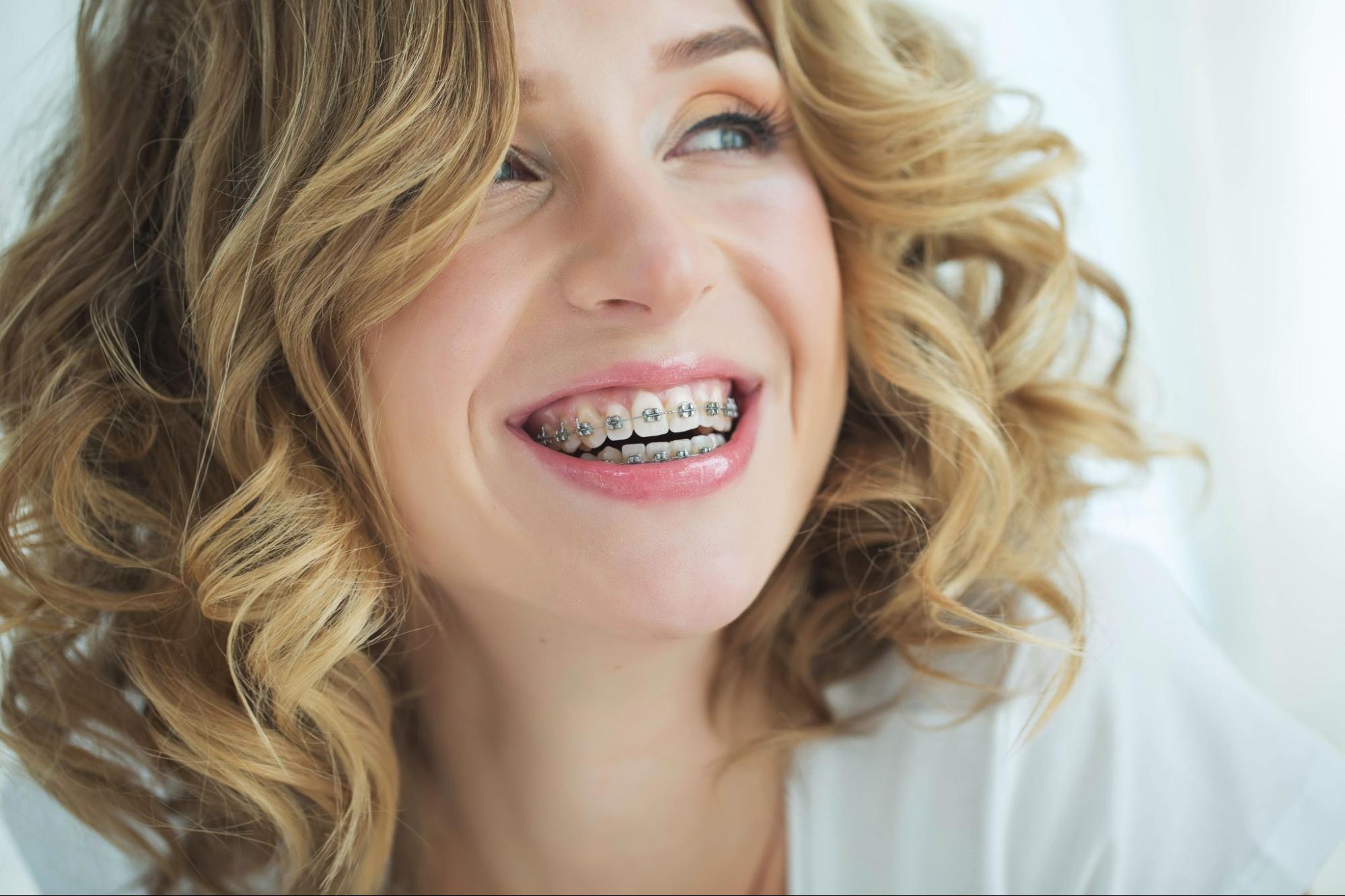 How Long Does Orthodontic Treatment Really Take?